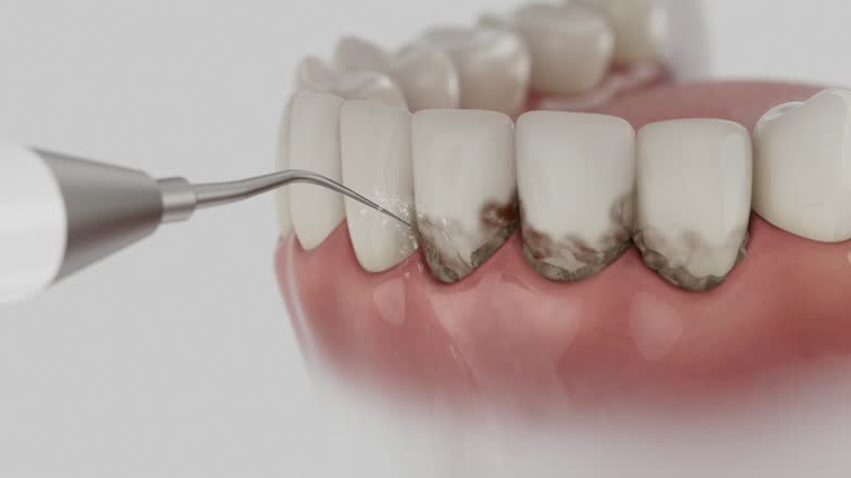 Reliable Dental Implants contractor in St. George, MO by Smile Center Dentistry